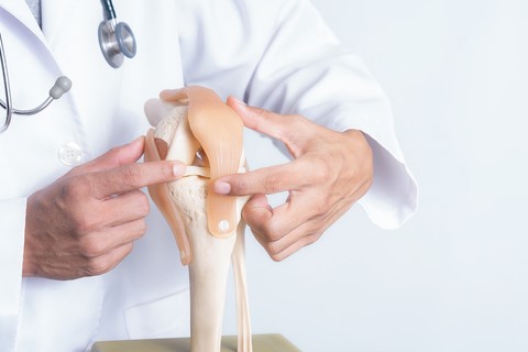 Imagen de un médico ortopédico especializado en accidentes carro en Long Island sosteniendo un modelo de rodilla.